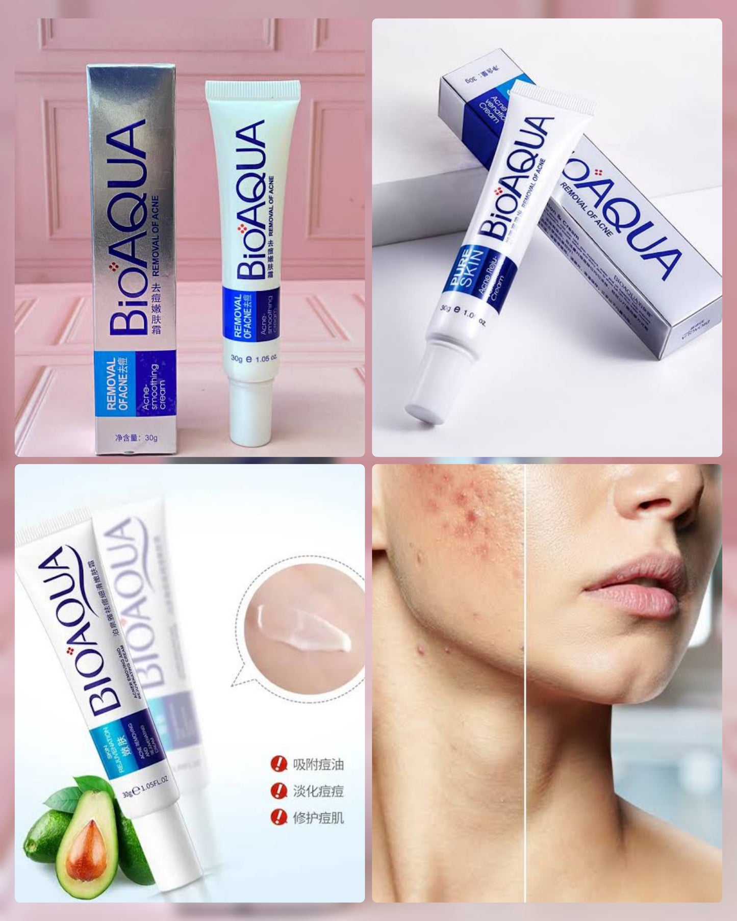 Crema anti acne bioaqua 30g