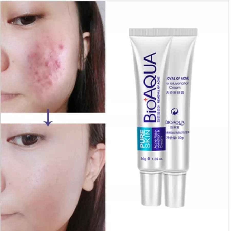Crema anti acne bioaqua 30g