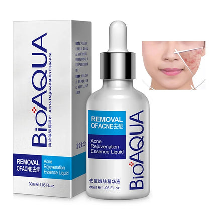 Serum anti acne bioaqua 30ml